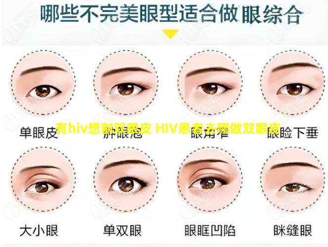 有hiv想割双眼皮 HIV患者去哪做双眼皮